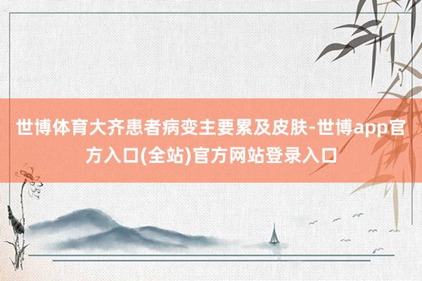 世博体育大齐患者病变主要累及皮肤-世博app官方入口(全站)官方网站登录入口