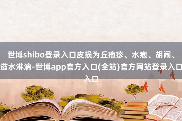 世博shibo登录入口皮损为丘疱疹、水疱、胡闹、滋水淋漓-世博app官方入口(全站)官方网站登录入口